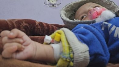 Les cas de malnutrition augmentent à Gaza, rapportent les hôpitaux, alors que peu d’aide et de nourriture parviennent à destination